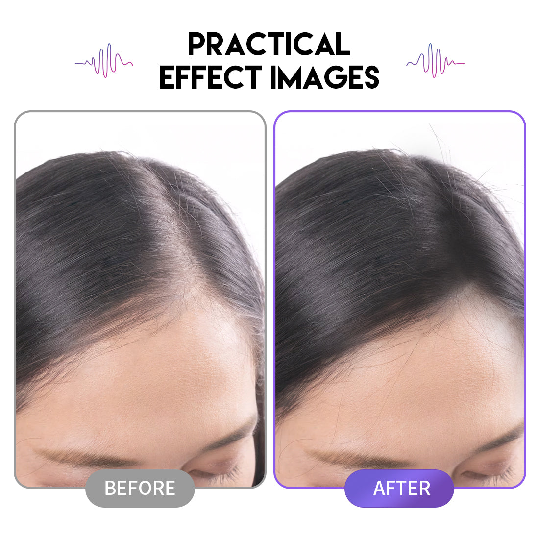 Mast Pro Tattoo Cartridges New Generation 2P Needle - Dragonhawktattoos